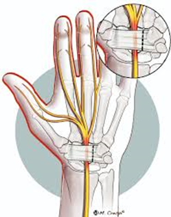 CHIRURGIA DELLA MANO